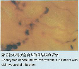 Microcirculation,high-resolution microscope,ultra microscope,high-magnification microscope