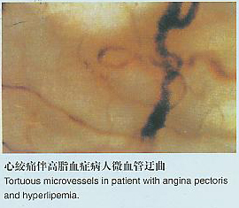 Microcirculation,high-resolution microscope,ultra microscope,high-magnification microscope
