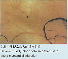 Microcirculation,high-resolution microscope,ultra microscope,high-magnification microscope