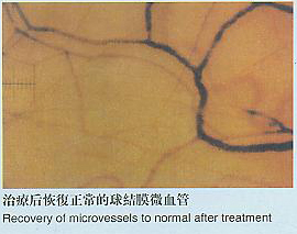 Microcirculation,high-resolution microscope,ultra microscope,high-magnification microscope