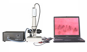 HD-WX-10-1(D Model) Portable Color Microcirculaţiei Microscope,microcycle Machine