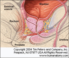 normal size prostate gland with concretions Fájdalom a prosztatában és a húgyhólyagban