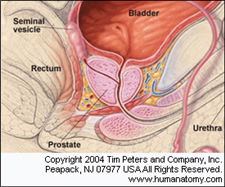 normal size prostate gland with concretions)