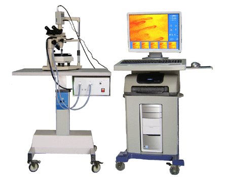 Microcirculation,high-resolution microscope,ultra microscope,high-magnification microscope