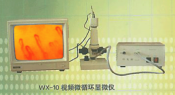 Microcirculation,high-resolution microscope,ultra microscope,high-magnification microscope